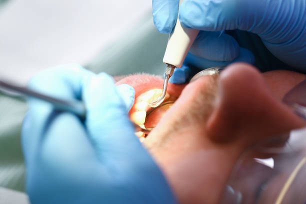 Best Emergency Denture Repair in Kure Beach, NC