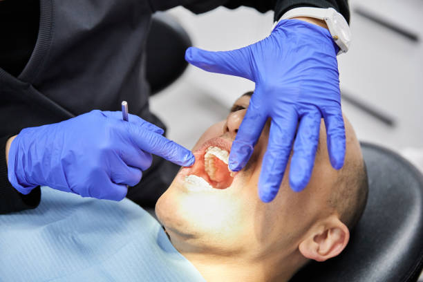 Best Urgent Care for Lost Fillings or Crowns in Kure Beach, NC